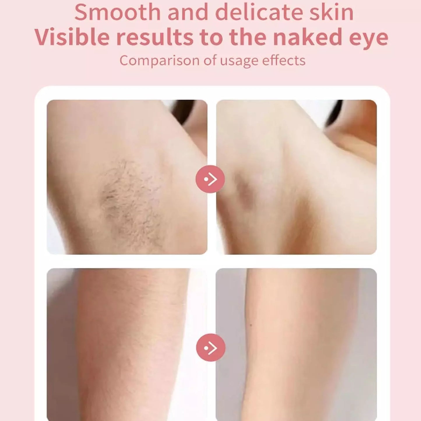 2 in 1 Electric Women Shaver Hair Arm Leg Bikini Face Remover Lady Razor Trimmer