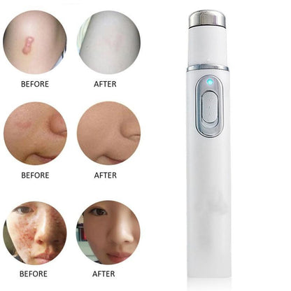 Medical Blue Light Therapy Laser Treatment Pen Acne Scar Wrinkle Removal Tools