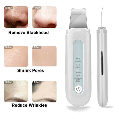 Ultrasonic Skin Scrubber Blackhead Peeling Remover Facial Peeling Deep Cleaner